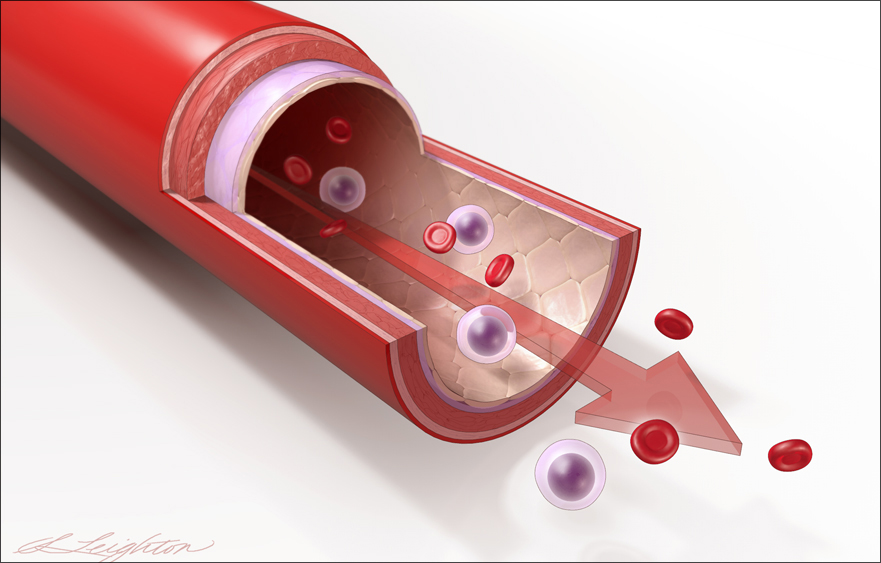 BloodFlow_Rule.jpg