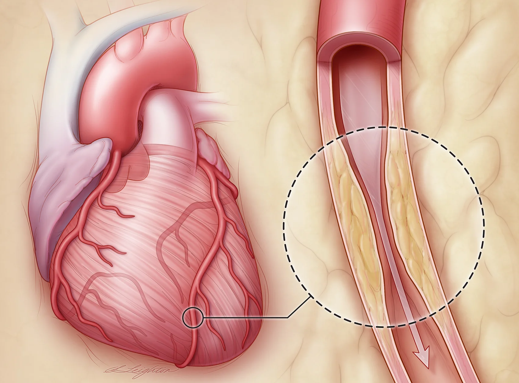 HeartCAD_Final.jpg
