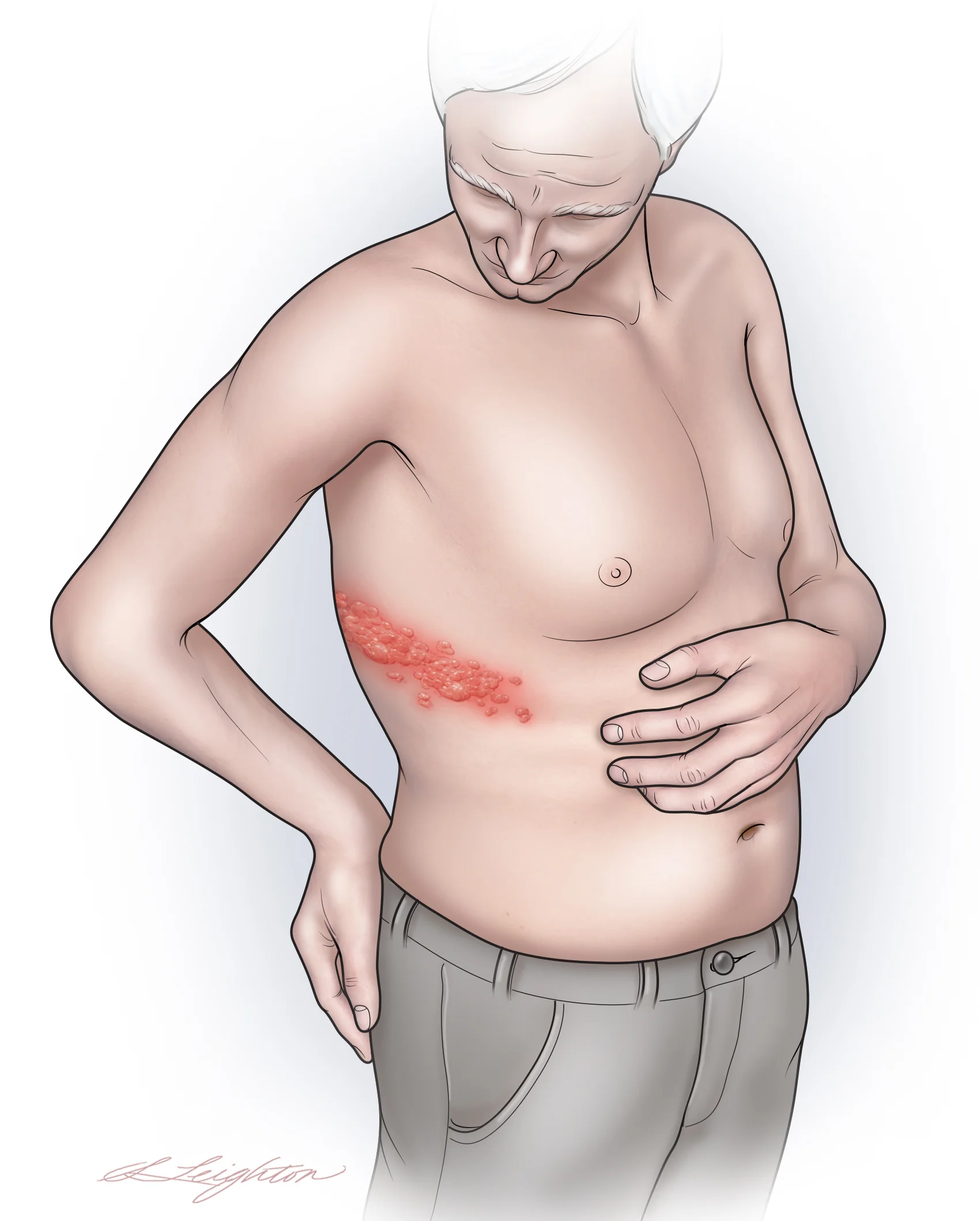 Shingles_Final.jpg