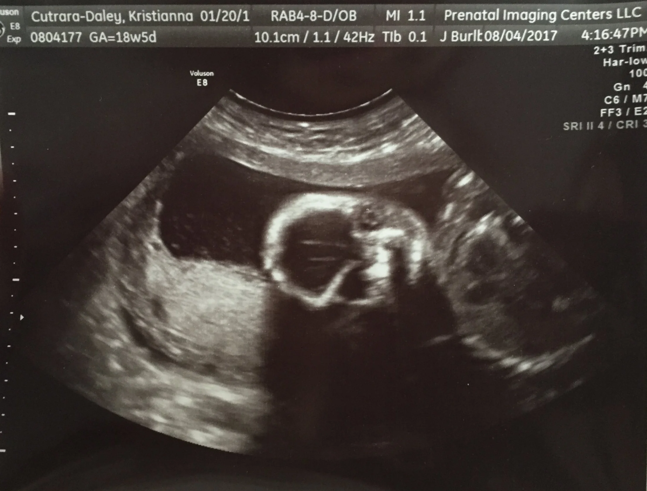 Part 4: The Art of Welcoming Life when you Hate Bringing it Forth - Reflections on Pregnancy and Womanhood