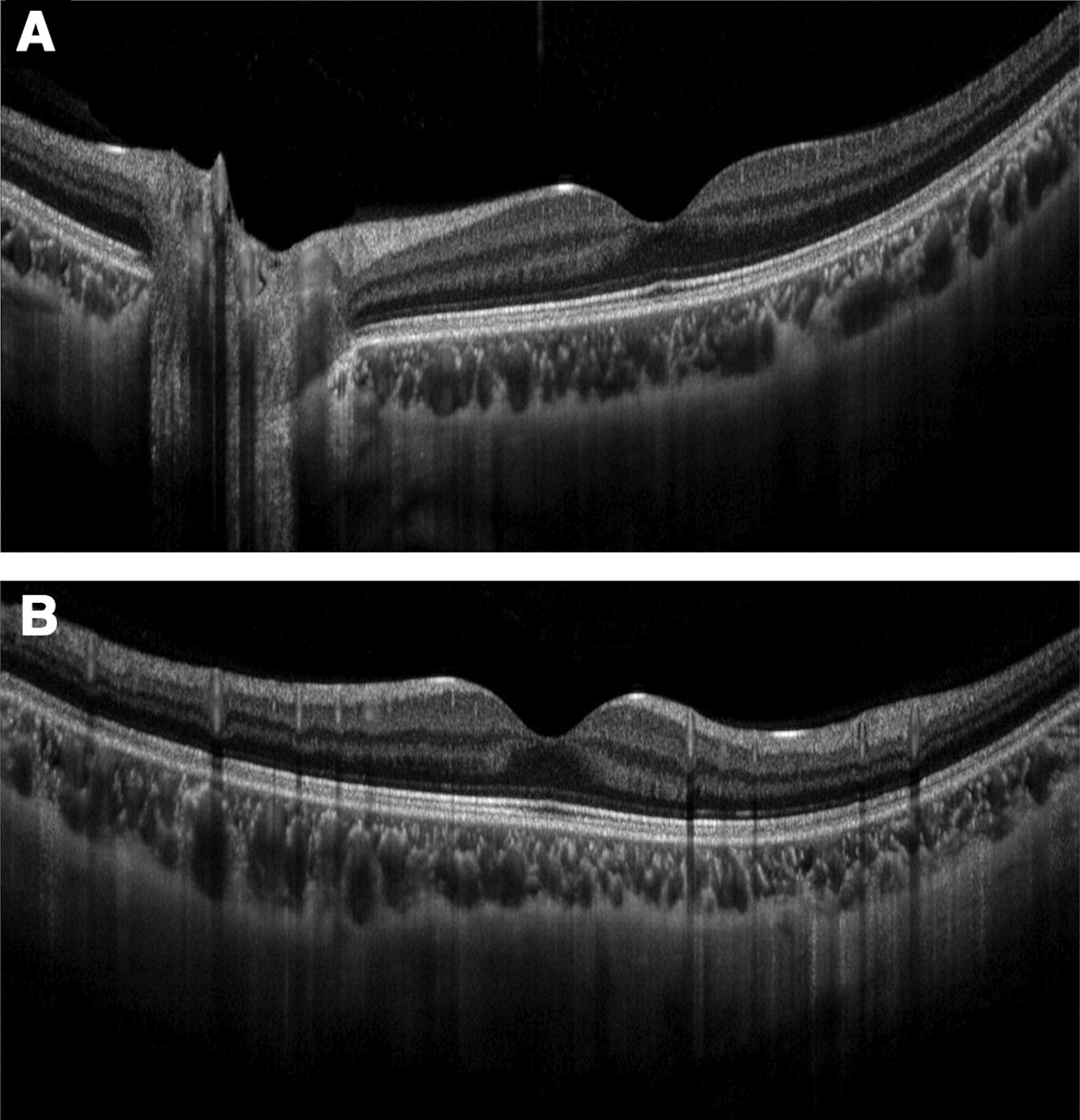 Retinal Image Optometrist Hamilton.jpeg