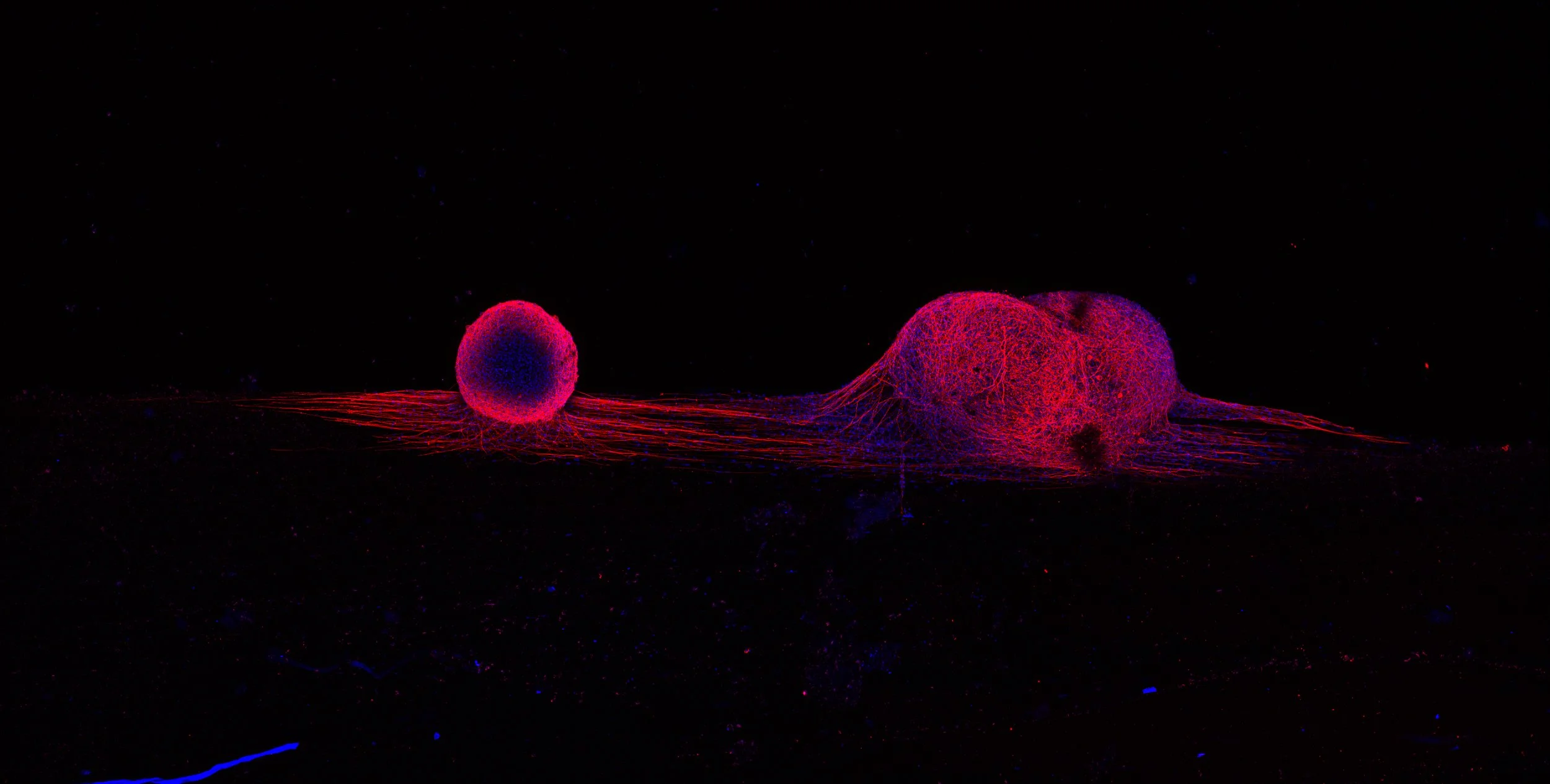 Dance of the Dorsal Root Ganglion .jpg