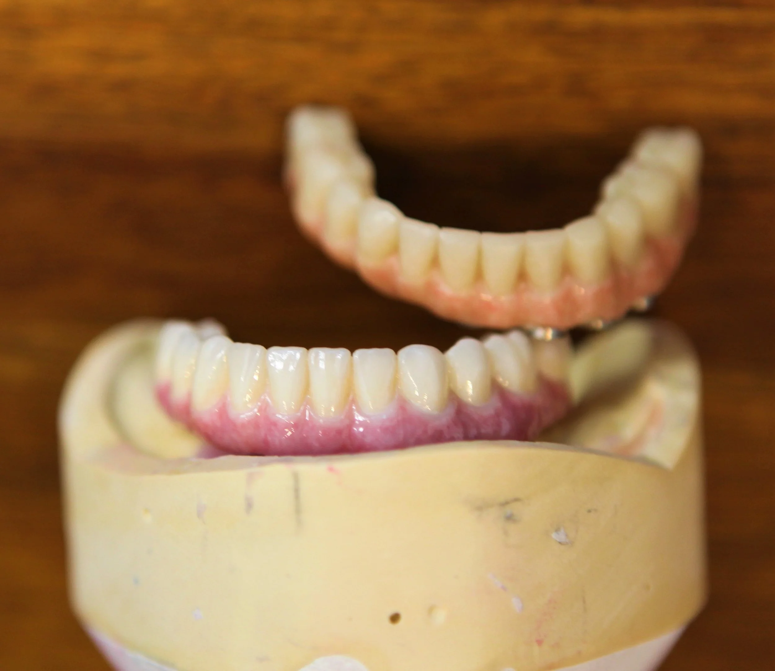 Upper and Lower PMMA Zirconia — Dynamic Dental Solutions