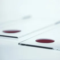 blood-test-kasraie.jpg