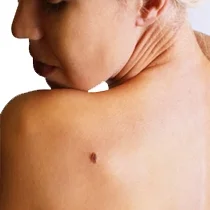 skin doctor in london chelsea