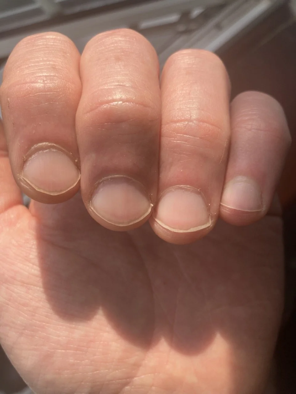 64434714174__0CF5CDE5-8491-44D0-BEF1-C1B6E5F2A3EC Large.jpeg