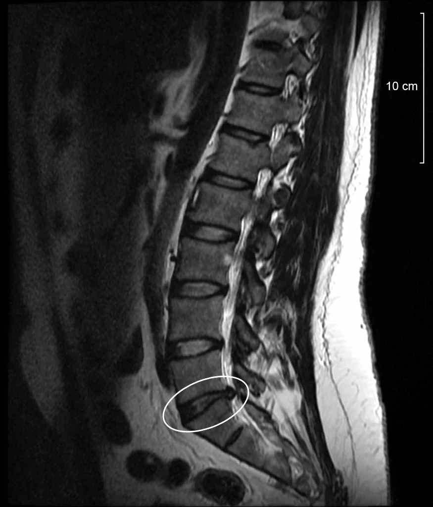  (not my mri, but you get the picture)