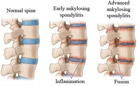 Let’s Talk Science and My Disabling Autoimmune Disease