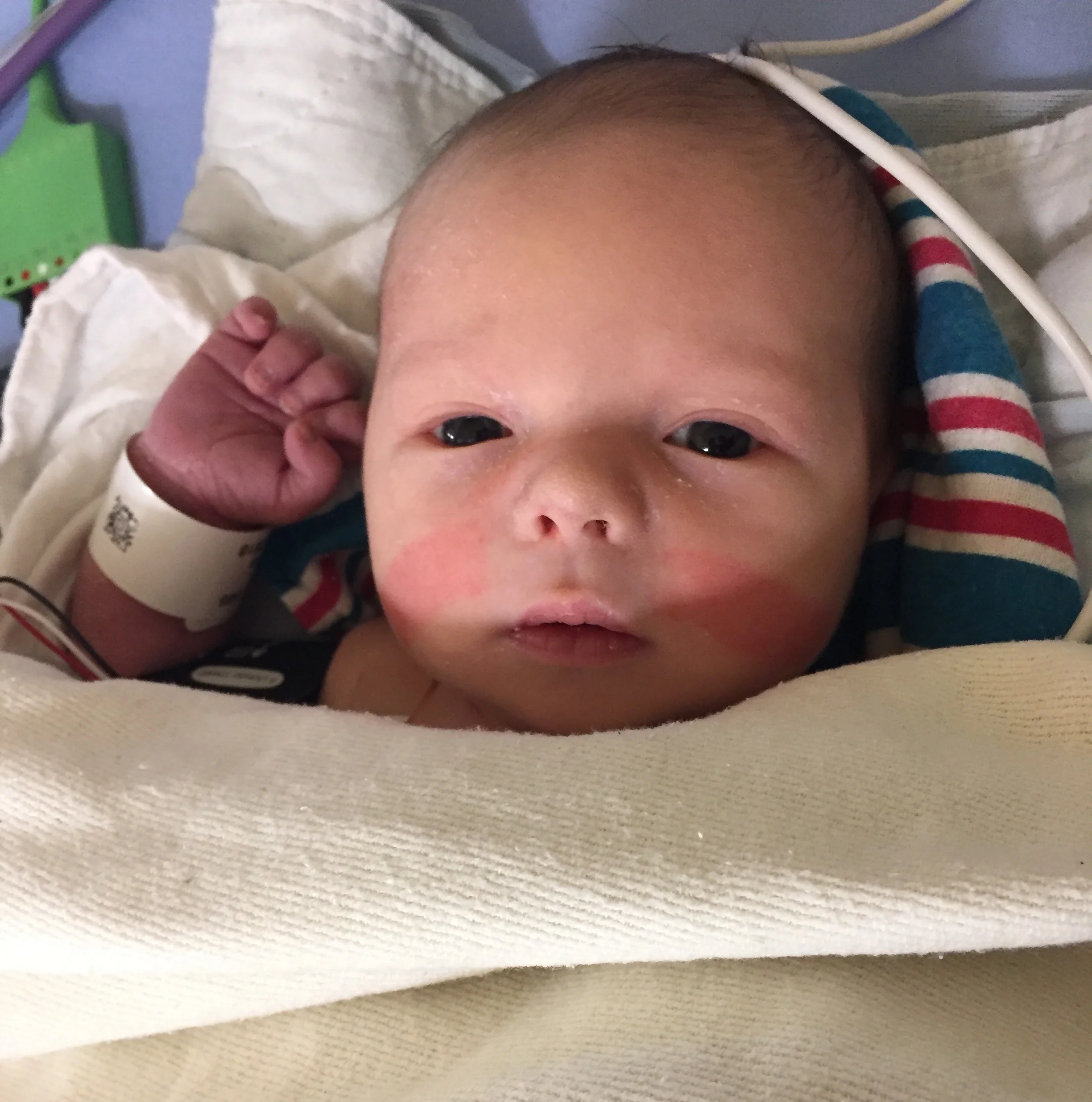 Lauchlan just waking up in recovery