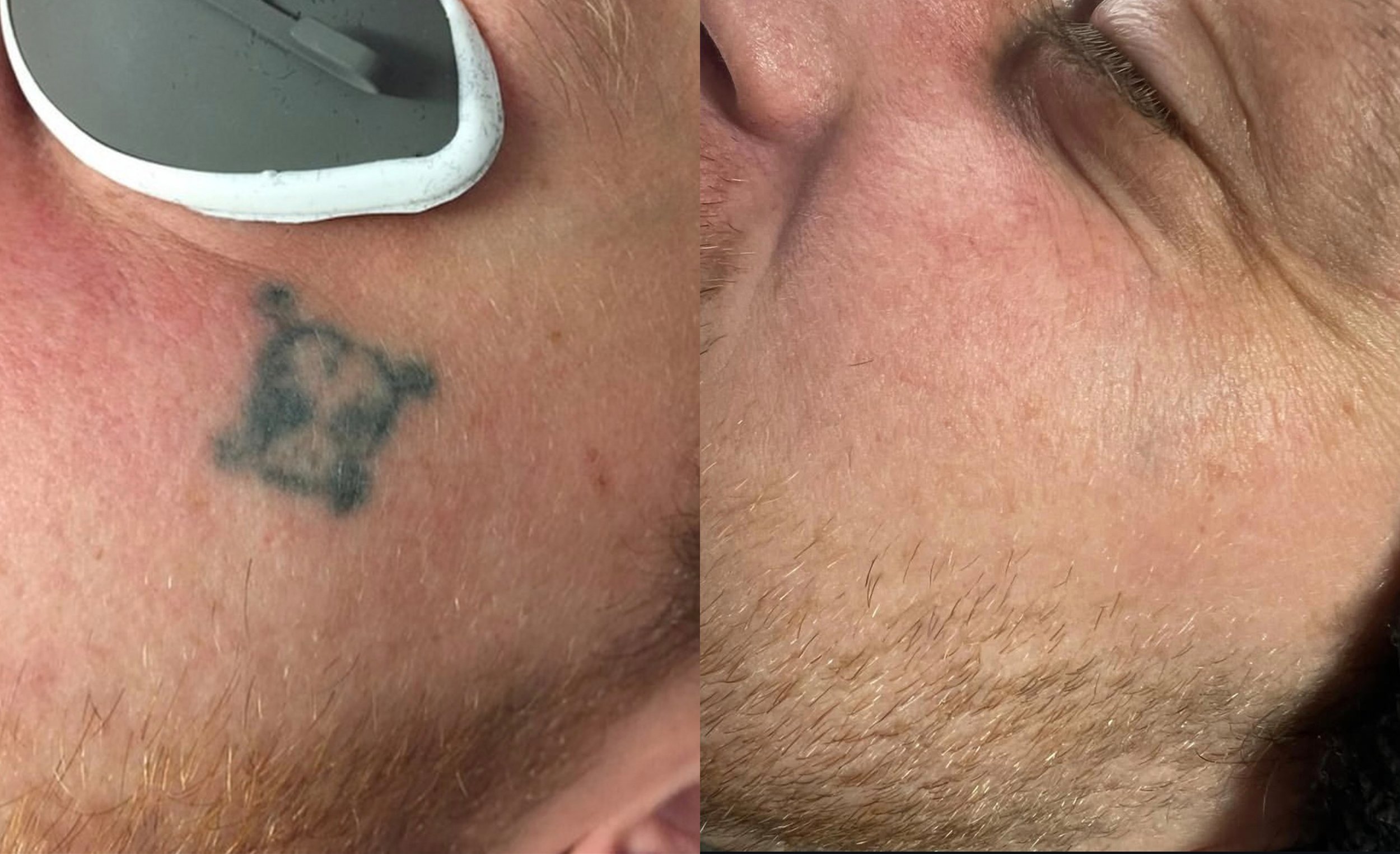 beforeandafter1.jpg