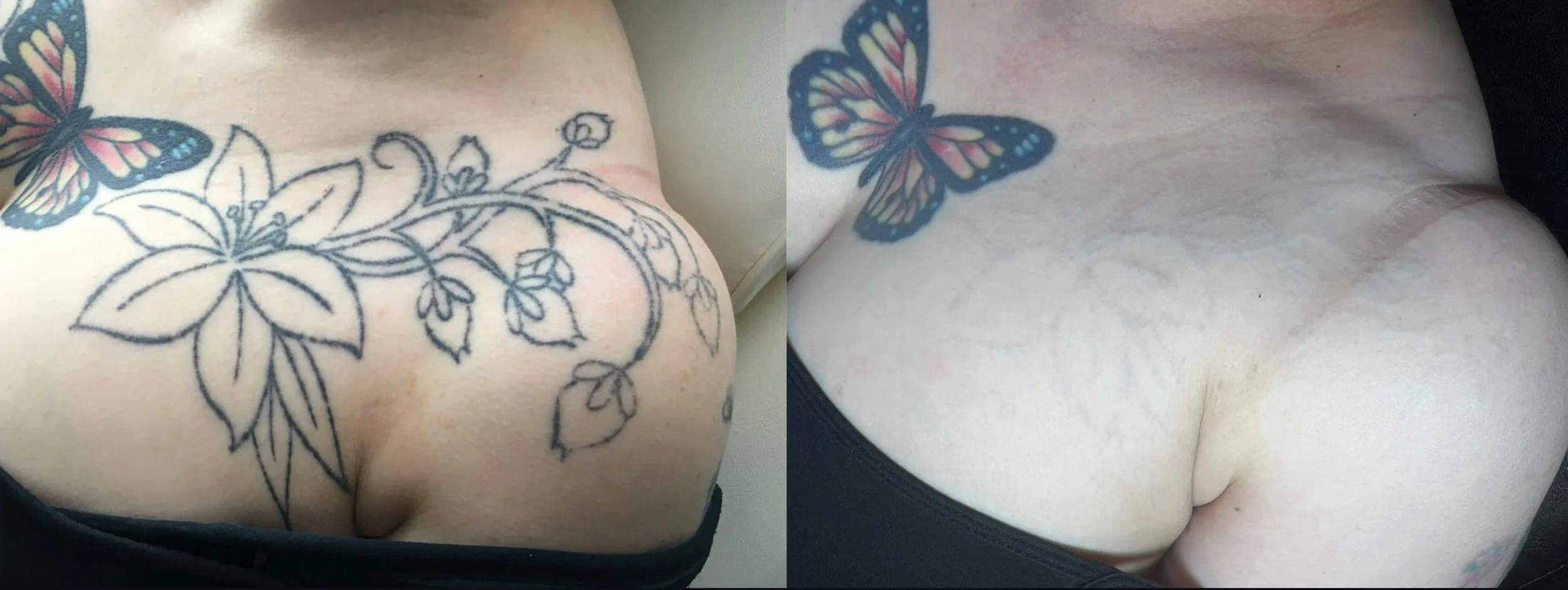 beforeandafter2.jpg