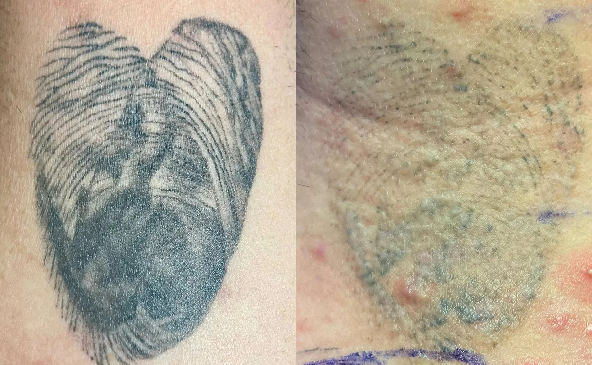 beforeandafter4.jpg