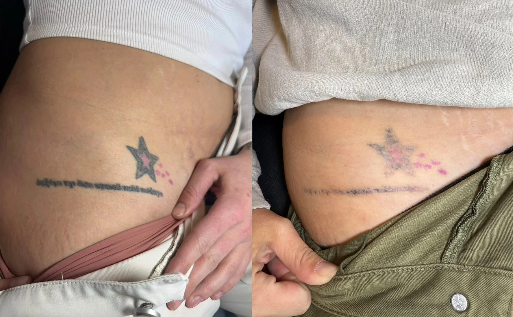 beforeandafter5.jpg