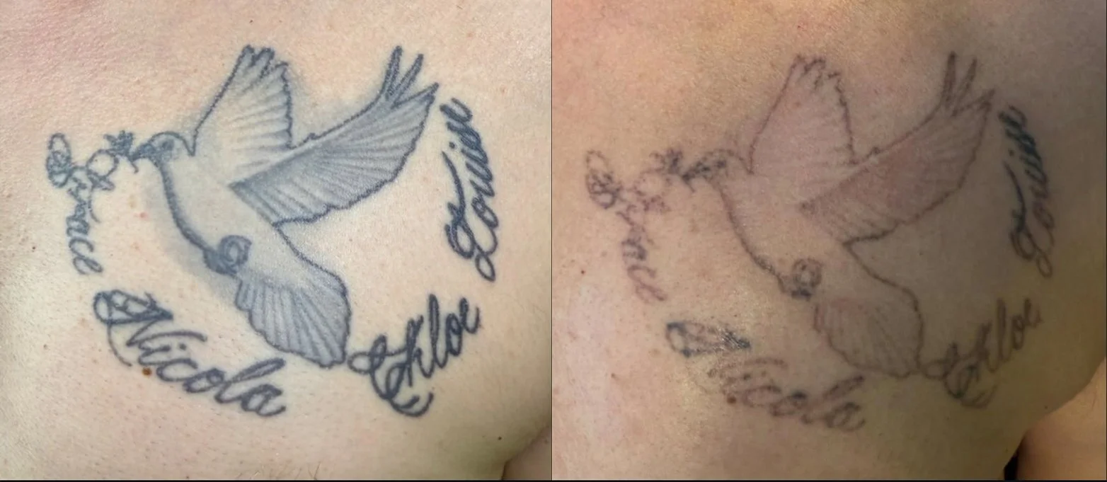 beforeandafter6.jpg