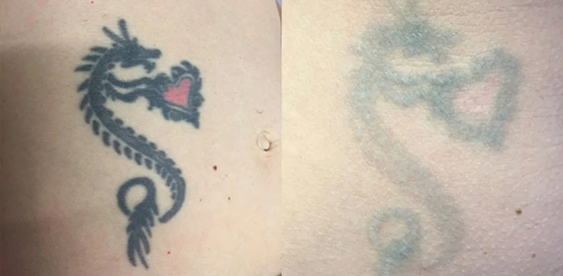 beforeandafter7.jpg
