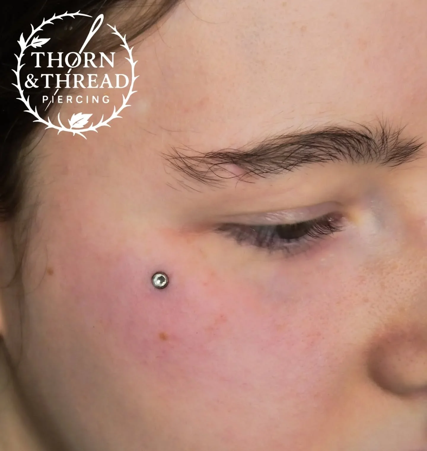 Dermal 🙌🏻🙌🏻🙌🏻

@realarttattoo 

#dermal #dermalimplant #facedermal #piercing