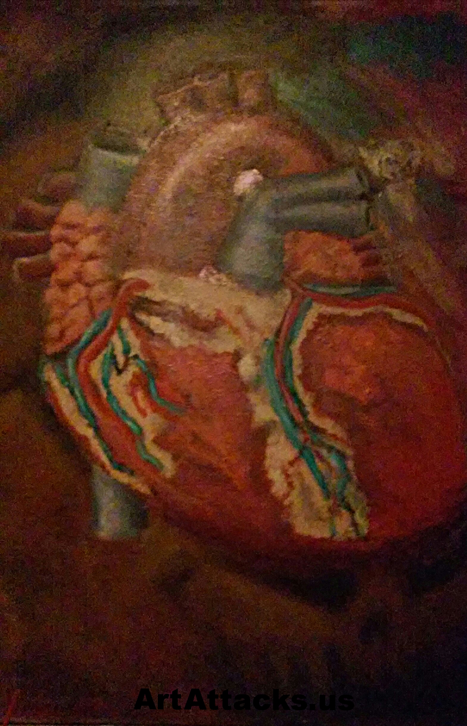 Heartache