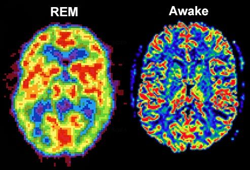 What sleep (recovery) looks like. 