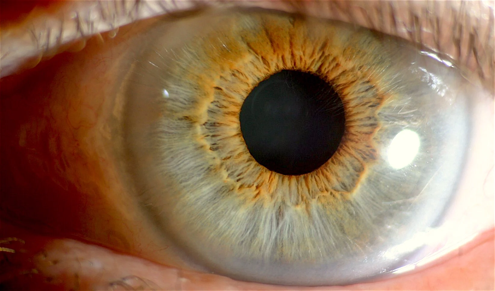 Iridology pictures 044[1].JPG