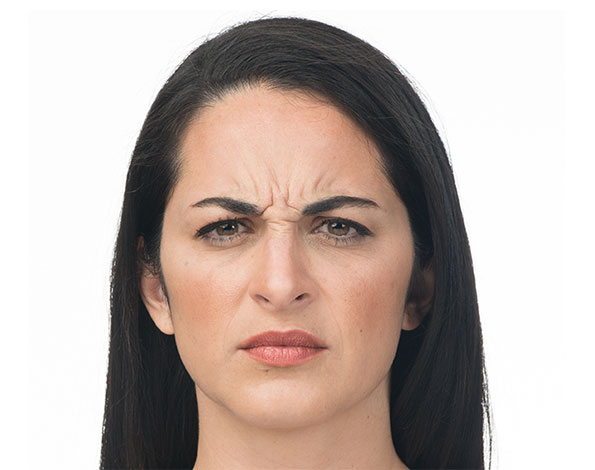 botox before 3.jpg
