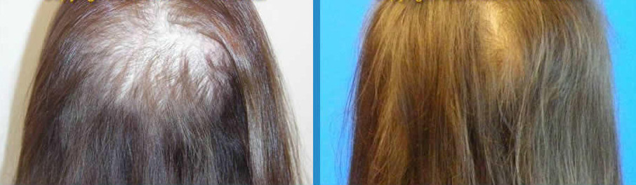 before-after-sunetics-3.jpg