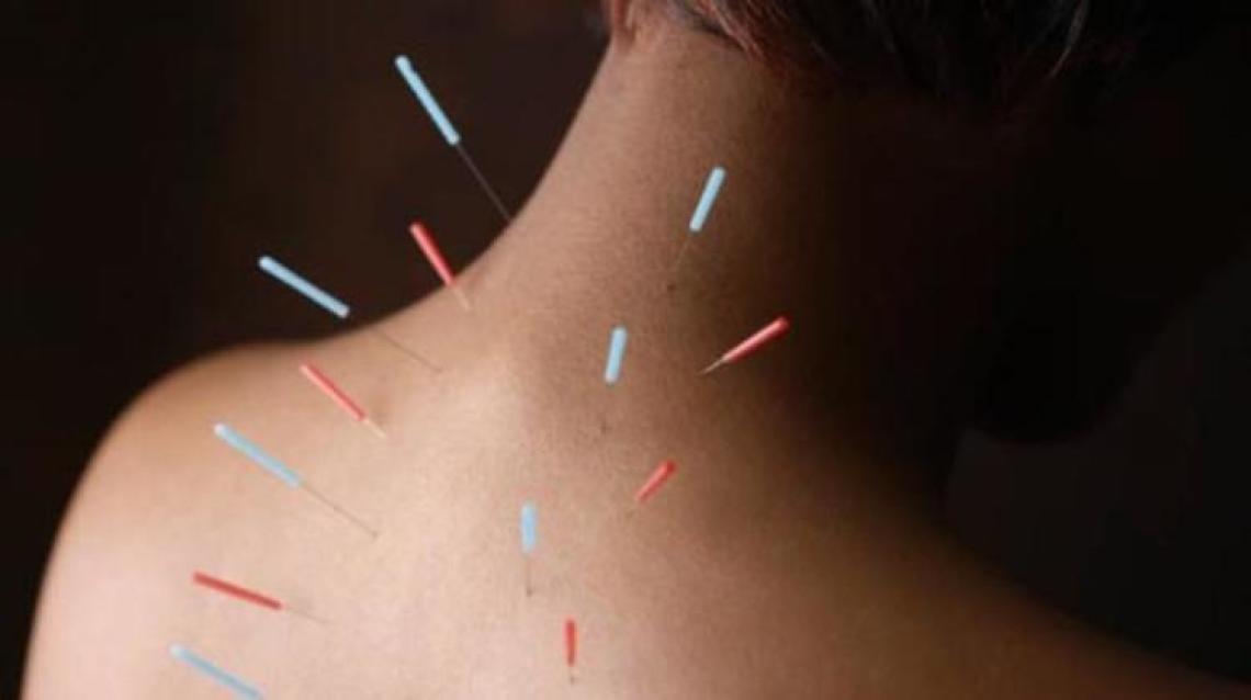 Bee Well Holistic Health - Acupuncture Therapy
