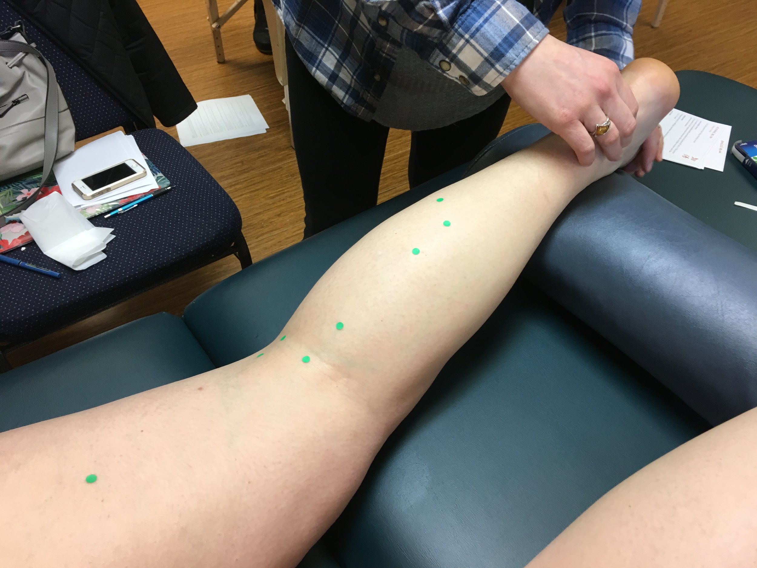 Finding acupuncture points on the extremities