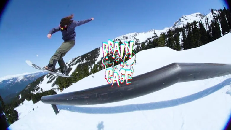 BRAINCAGE | StarBoiiz 