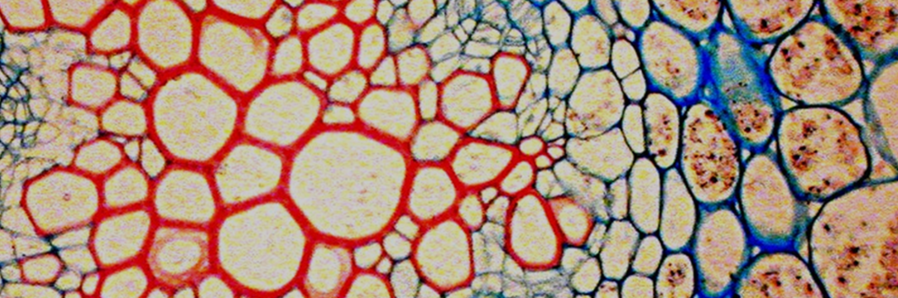 LINXS - FOOD COLLOIDS AND STRUCTURED INTERFACES INDUSTRY WORKSHOP