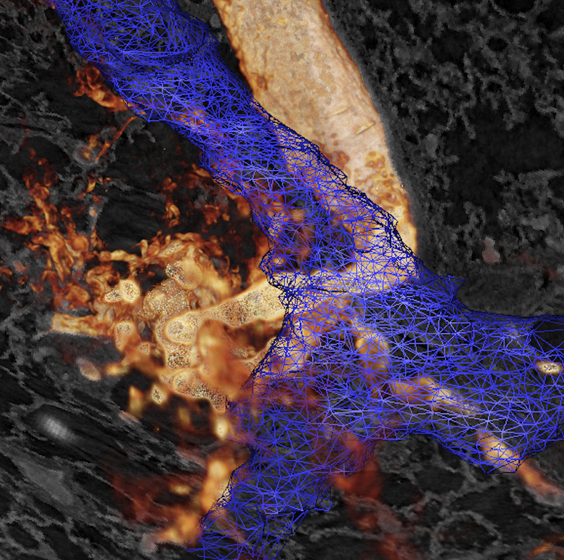 3D histology with synchrotron micro-tomography: Symposium and hackathon– IPDD theme