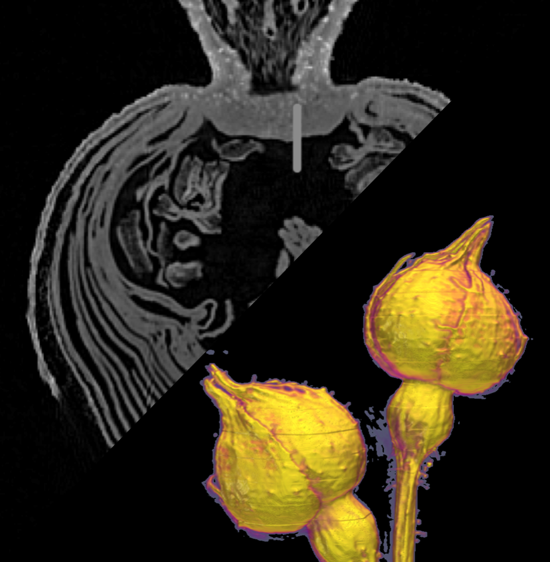 ADVANCED IMAGING AND DATA ANALYSIS