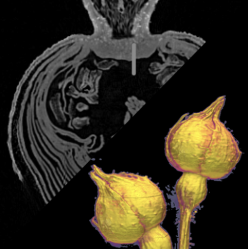 OPTIR Workshop at MAX IV - AIDA