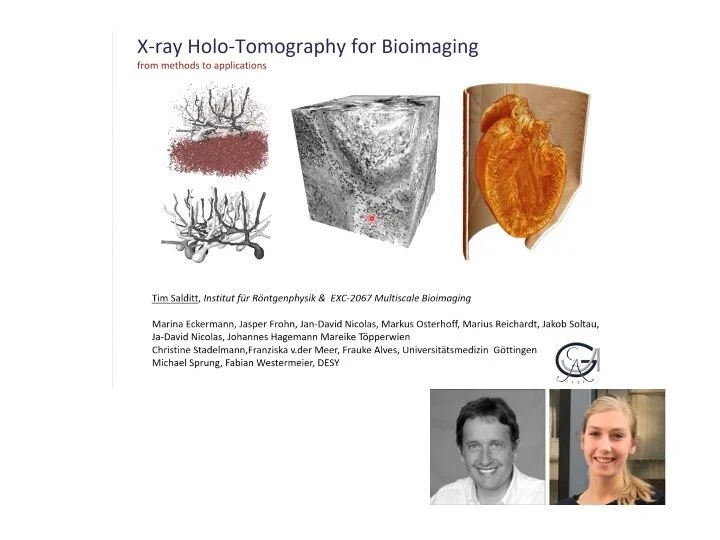 VIDEO - CoWork series - Holographic tomography as a new tool for bioimaging and 3d Virtual Patho‐Histology of Lung Tissue from Covid‐19 Patients, with Tim Salditt &amp; Marina Eckermann