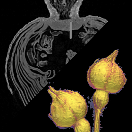 Advanced Imaging and Data Analysis Theme