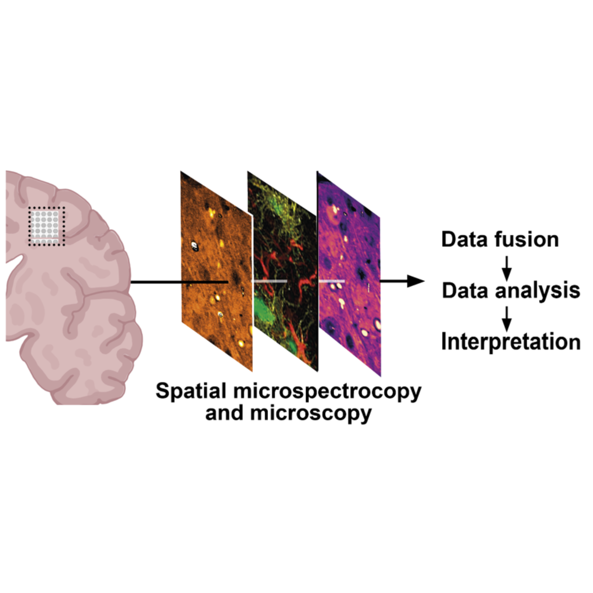  Advanced Imaging for Brain Understanding – Bridging Imaging, Spectroscopy and AI Across Scales - AIDA-SHINE