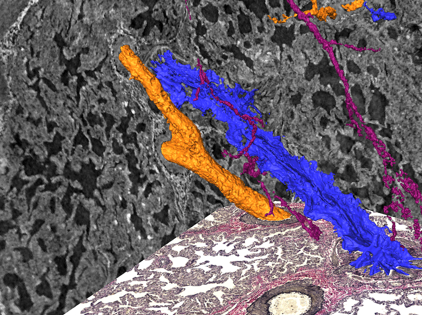 Workshop – Different Questions, Shared Challenges: Image Analysis Across X-ray Tomography – AIDA