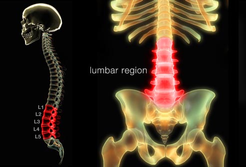 low back.jpg