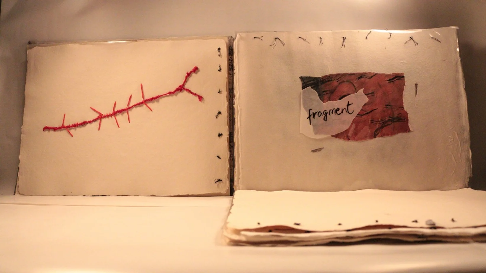 18 RUCHIKA WASON SINGH - The Cancer Diary- I.JPG