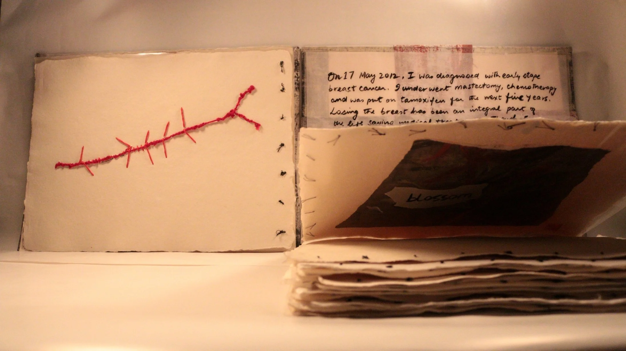 26 RUCHIKA WASON SINGH - The Cancer Diary- I.JPG