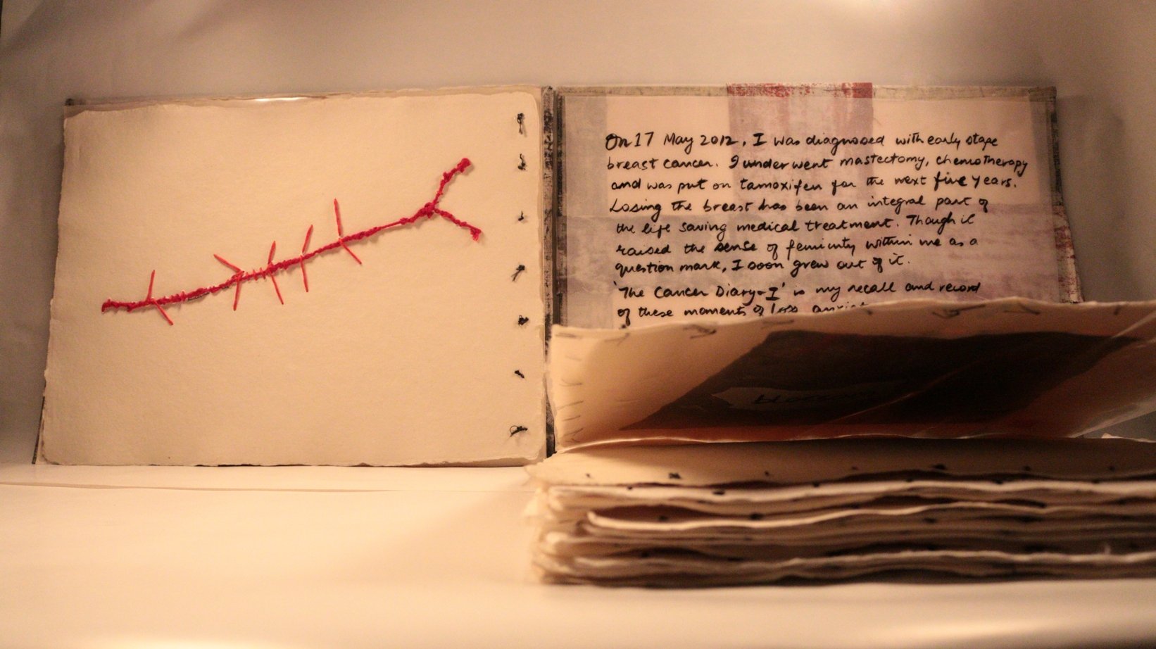 27 RUCHIKA WASON SINGH - The Cancer Diary- I.JPG