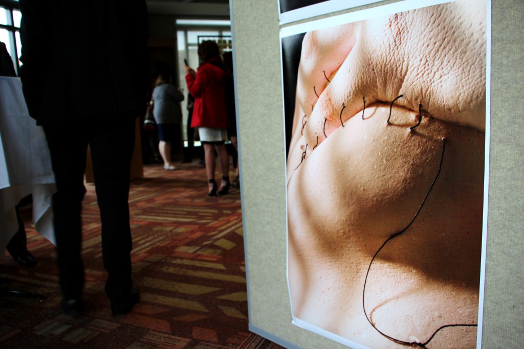   Emma Haase's artwork titled "Stitches", showcased at The Ohio State University's Survivor Gala in honor of victims of sexual violence and assault. April, 2015.  