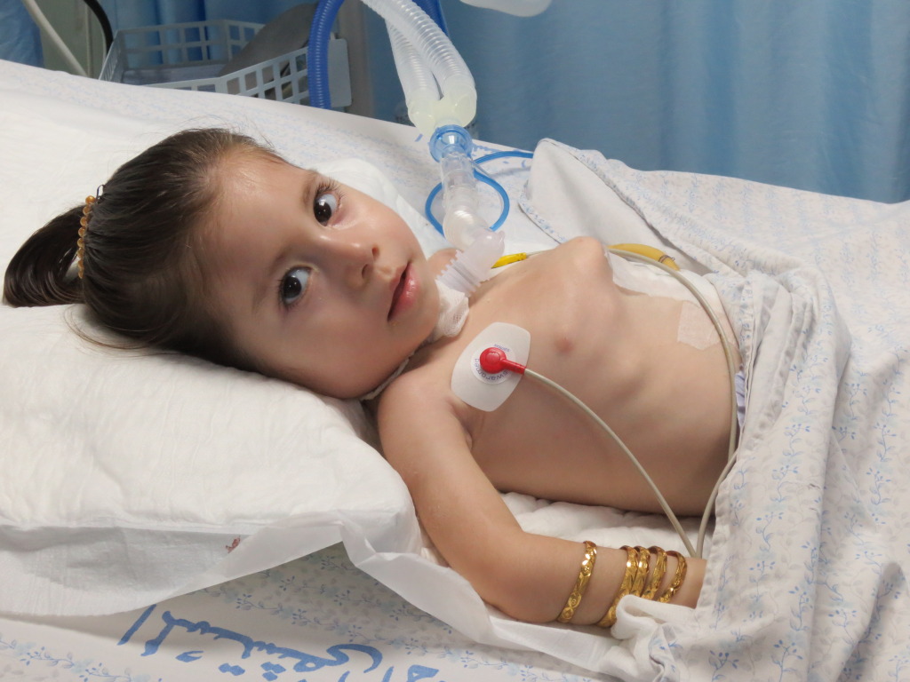    Two-year-old Dana Sidir sits in the ICU of a hospital in al-Khalil, West Bank with respiratory paralysis. June, 2012.   