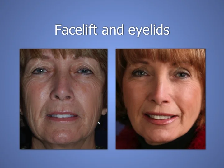 Slide121.jpg