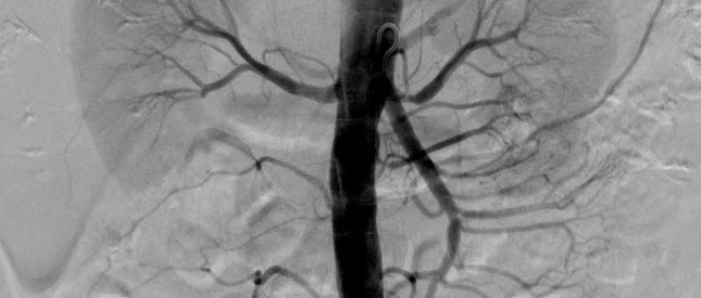 Peripheral Intervention 7.jpg