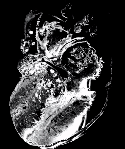 ALLVALDR