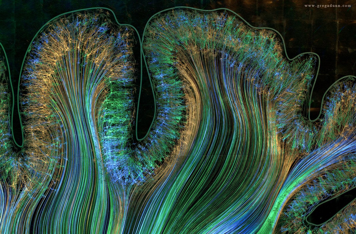 Motor-and-Parietal-cortex1.jpg