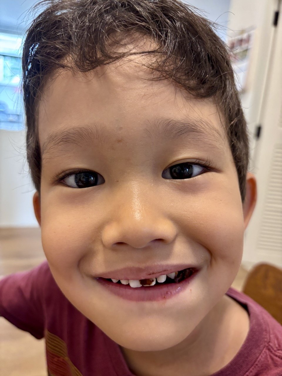 Did Arlo lose a tooth? No! That's just a messy chocolate breakfast!