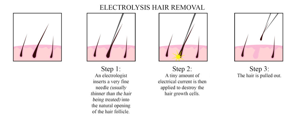 hair removal learn more — LHP4Beauty Lhp Private one-on-one Salon, Spa &  Wig Making Workshops