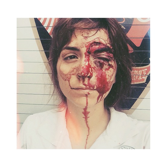 THE AUTHOR IMMEDIATELY AFTER A HORSE HOOF TO THE FACE