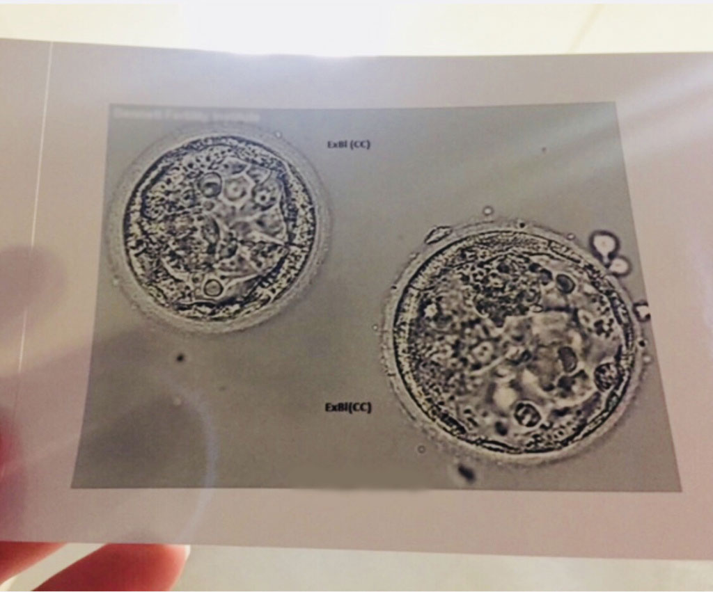 two-embryos.jpg